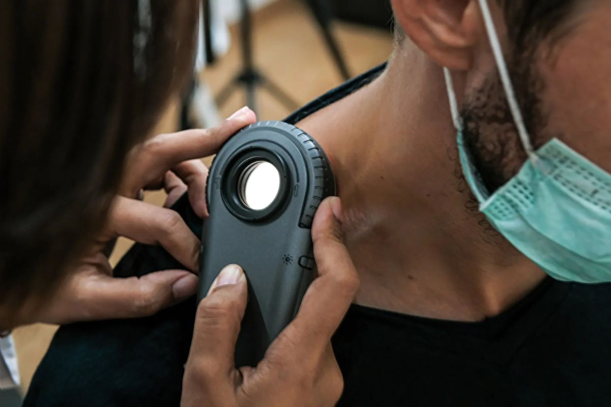 The Science Behind the Removal of Moles Safely and Effectively